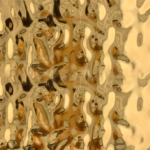 ميتا ليك استيل بديل شيبورد ذهبي